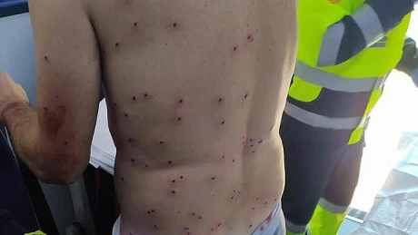  4fb5fe65-f51c-4551-9a73-71dec2cfbc24_16-.jpg 



https://www.informacion.es/alicante/2021/11/29/ciclista-herido-alicante-despues-cazador-60116557.html


Un 90